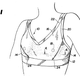 Illustration for article titled A Brief History Of The Sports Bra